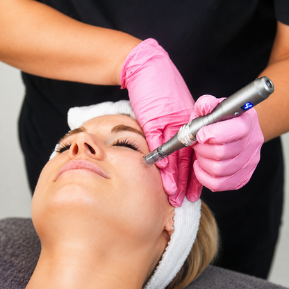 Sothy's Micro-Needling Facial